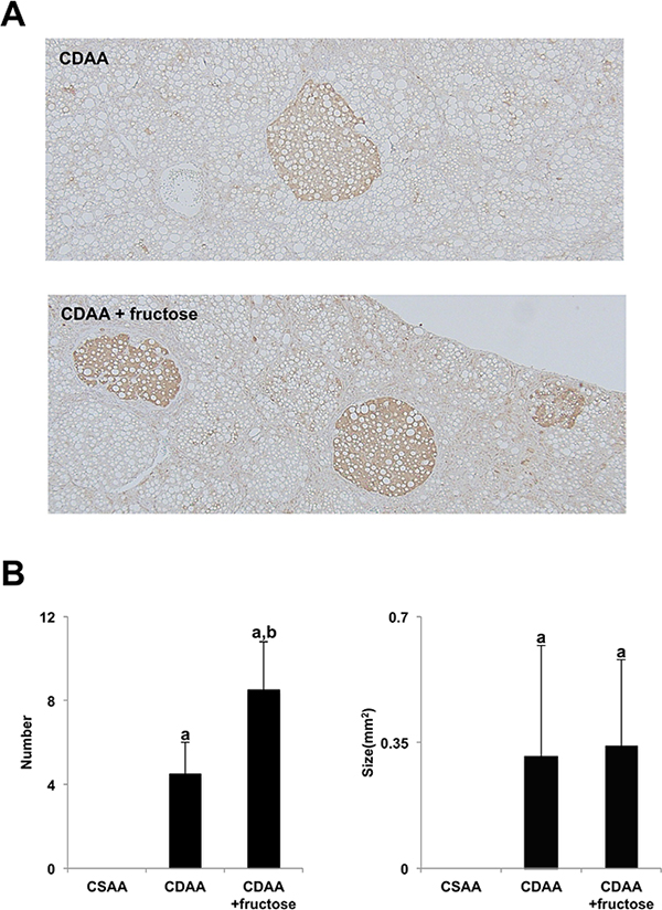 Fructose augmented CDAA-induced hepatocarcinogenesis.