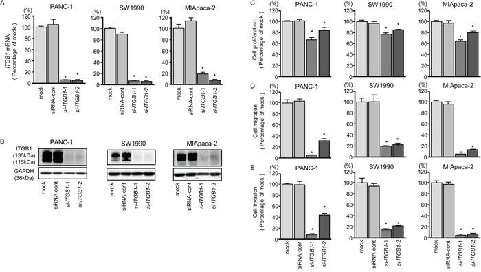 ITGB1 mRNA and protein expression after si-ITGB1 transfection and effects of ITGB1 silencing in PDAC cell lines.