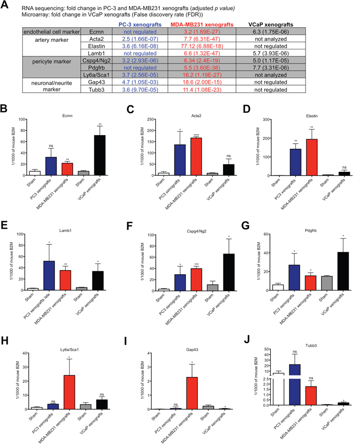 Expression analysis of endothelial cell, artery, pericyte and neuronal/neurite markers in osteolytic and osteoblastic bone metastasis.