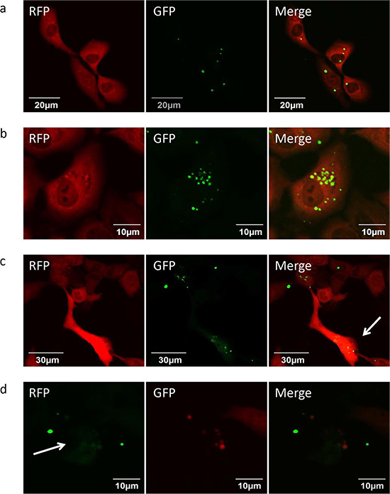 Efficacy of S. typhimurium A1-R on HT-1080 fibrosarcoma cells in vitro.