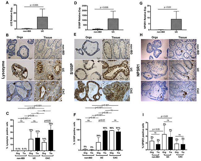 qRT-PCR and IHC validation of enrichment delineated by ChIP-seq and transcriptome analysis for UC and extended to colitis-associated cancer.