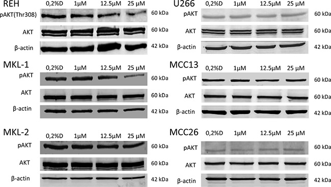 Western blotting of AKT phosphorylation (p-AKT) in idelalisib treated cell lines REH, MKL-1, MKL-2, MCC13, MCC26 and U266.
