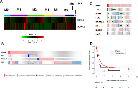 High MIXL1 expression denotes a distinct subset of AML.