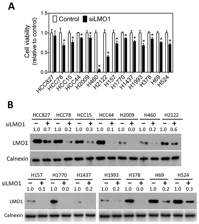 Knock-down of LMO1 expression decreases survival of lung cancer cells.