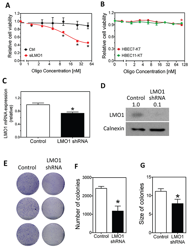 Effect of LMO1 knockdown on cell survival and colony formation in H1993 cells and HBECs.