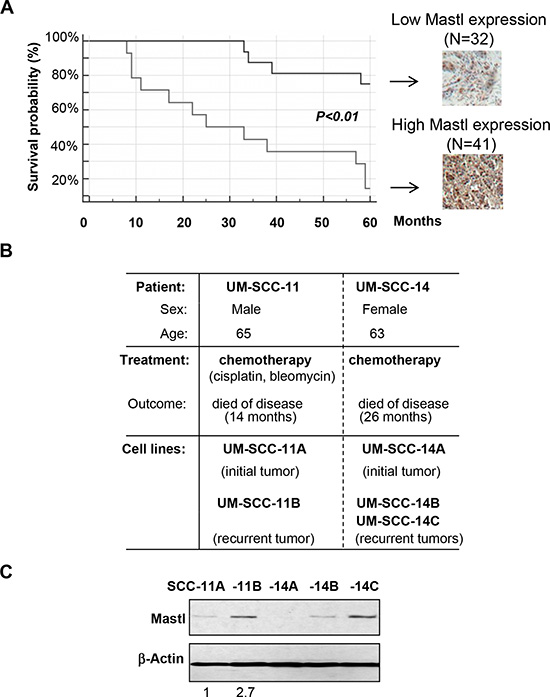 Mastl upregulation is correlated with poor patient survival and tumor recurrence.