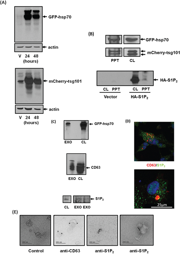 Identification of S1P2 in exosomes shed from MDA-MB-231 breast cancer cells.