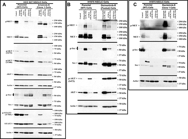 Altered oncogene expression in EGFR TKI-resistant NSCLC cells.