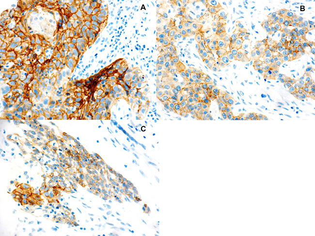 Immunohistochemical staining for E-cadherin expression.