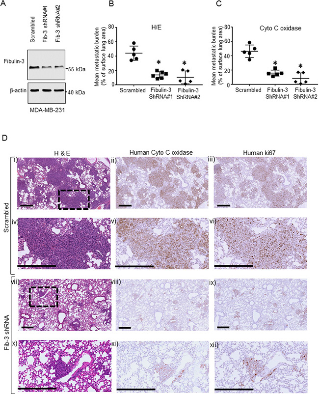The effects of Fibulin-3 knockdown on TNBC metastasis.