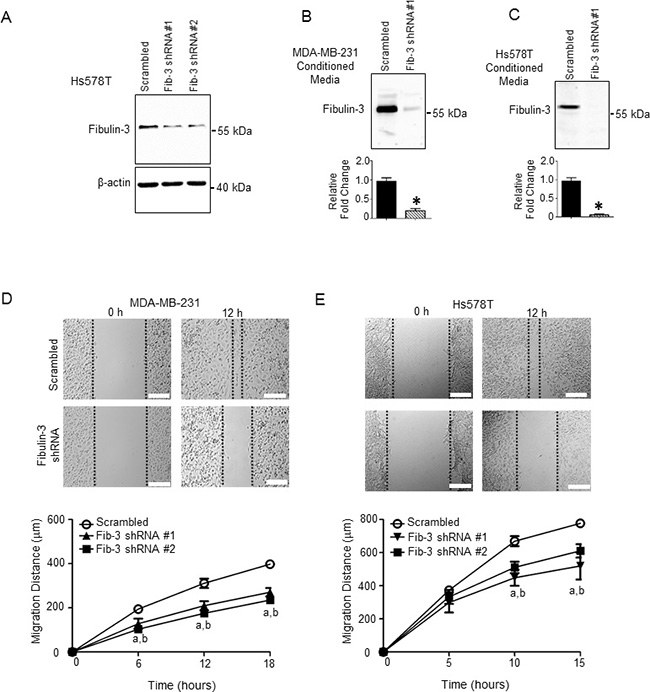 Fibulin-3 knockdown in TNBC cells decreases TNBC cell motility.