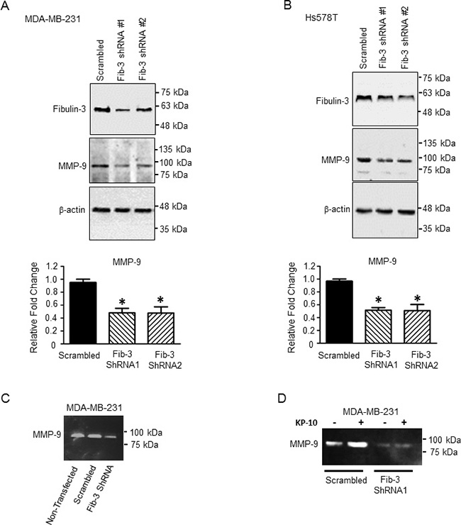 Downregulation of fibulin-3 in TNBC cells decreases the expression and activity of MMP-9.