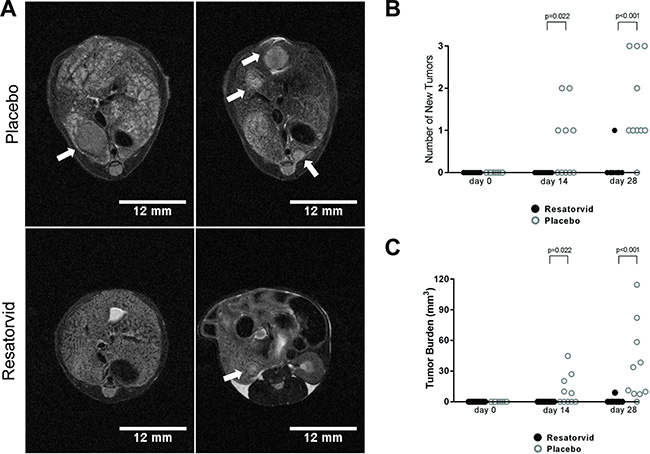 Resatorvid prevents HCC development in HepPten- mice.