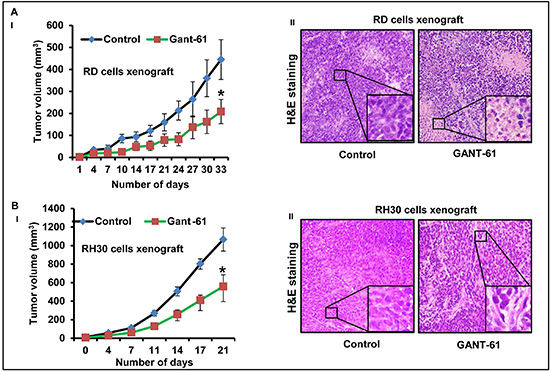 GANT-61 treatment inhibits eRMS (RD) and aRMS (RH30) cells-derived xenograft tumor growth.