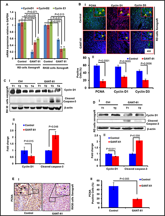 GANT-61 treatment reduces proliferation and induces apoptosis in RMS xenograft tumors.