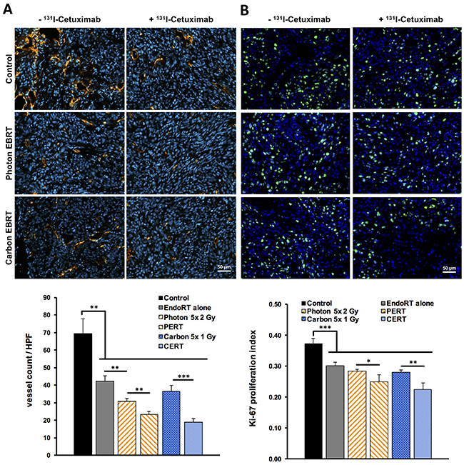 Reduced tumor proliferation and microvascular density after combined EBRT and 131I-Cetuximab endoradiotherapy.