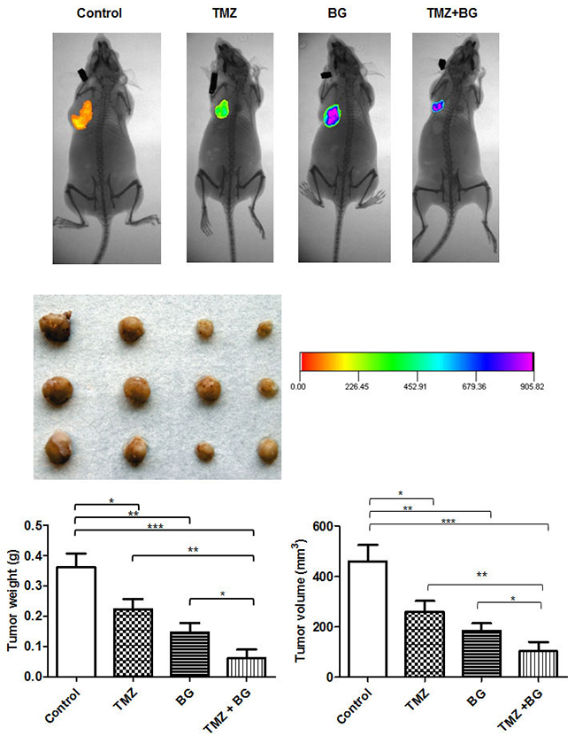 BG increases TMZ inhibitory effect on breast cancer growth in vivo.