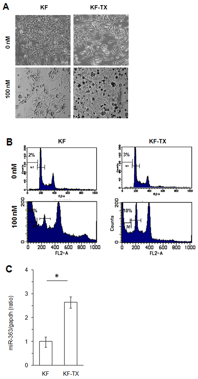 miR-363 is upreguated in the TX-resistant versus responsive ovarian cancer cells.