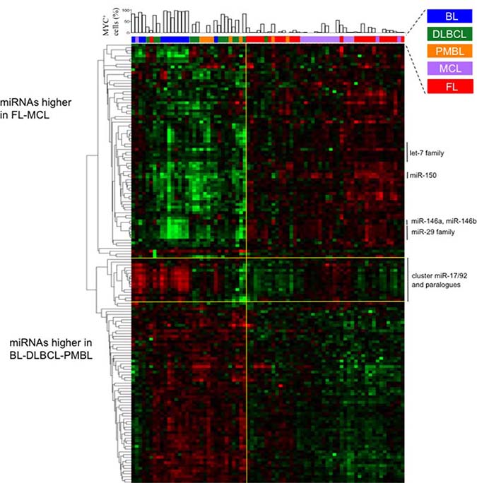 Levels of miRNAs differentially expressed among BL, DLBCL, PMBL, MCL and FL samples.
