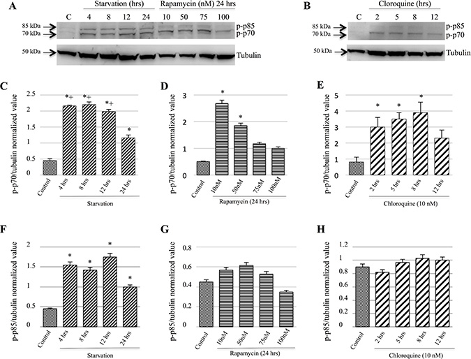p-p70 and p-p85 S6 Kinase proteins expression were induced during starvation.