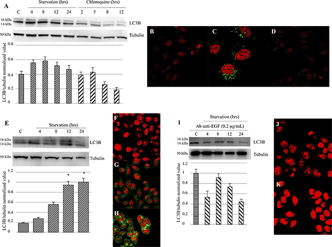 Evaluation of LC3B activation and expression.