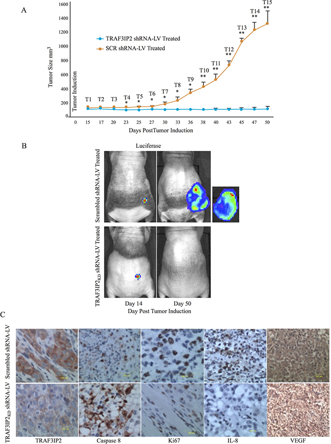 Effect of silencing TRAF3IP2 in a flank xenograft model.