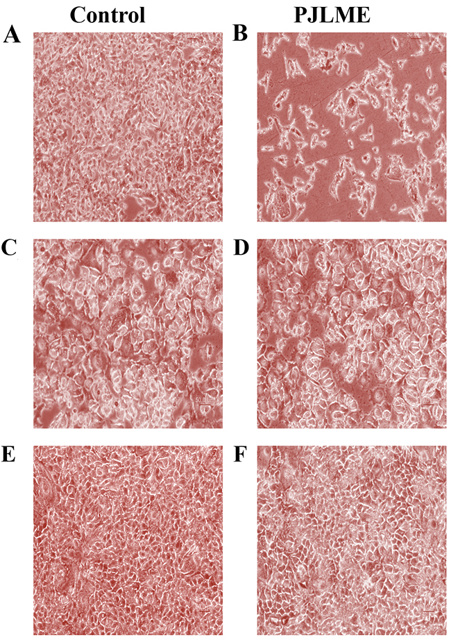 Effect of PJLME on morphology of MDA-MB-231, MCF-7 and HaCaT cells.