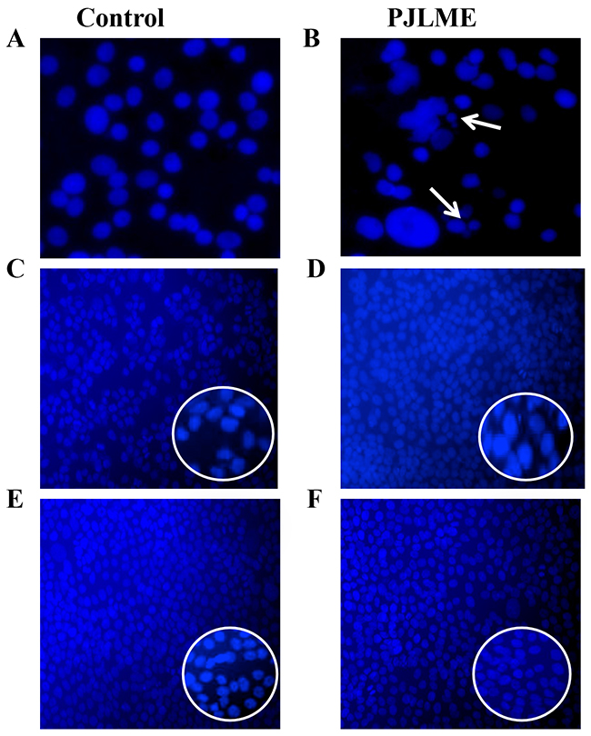 Detection of PJLME induced nuclear fragmentation.