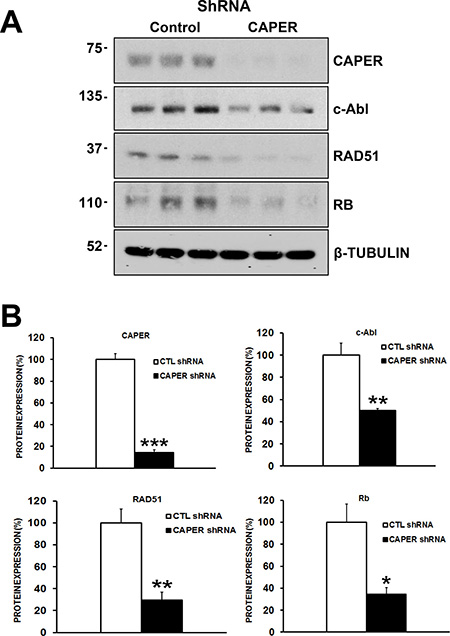 CAPER Knockdown decreases the levels of c-Abl, RAD51 and retinoblastoma proteins, essential proteins involved in homologous recombination repair of DNA in MDA-MB-231 cells.