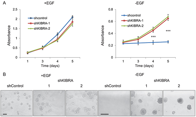 KIBRA knockdown induces growth factor-independent cell proliferation.