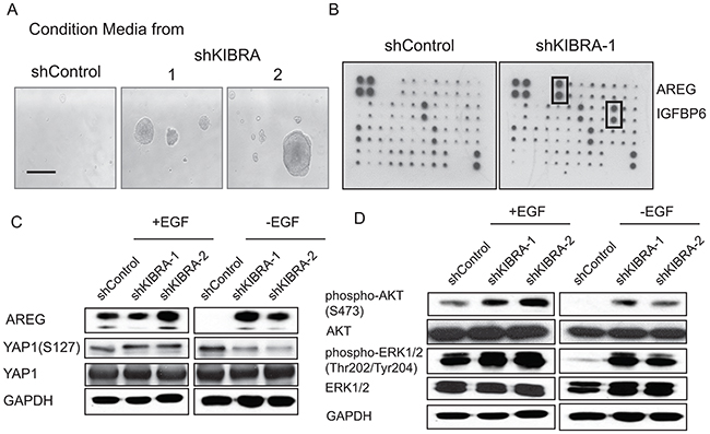 KIBRA knockdown induces the secretion of the EGFR ligand AREG.