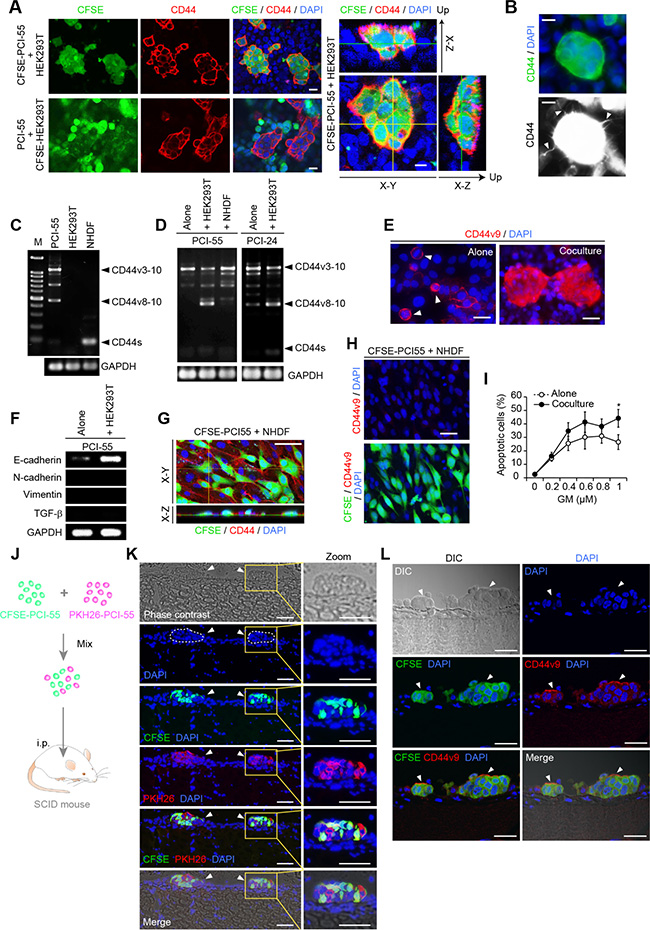 Ad-MCA-forming CD44v3-10high/CD44slow PDAC cells increase CD44v8-10 expression.