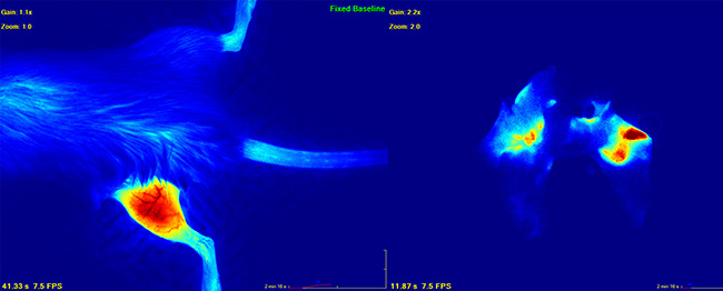 Figure 4: Image depicting primary (left) and metastatic lung (right) osteosarcoma as visualized by indocyanine green dye angiography.