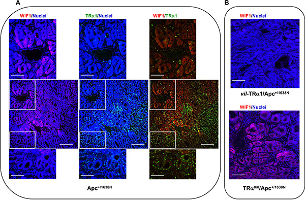 Analysis of TR&#x03B1;1 and WIF1 expression domains.