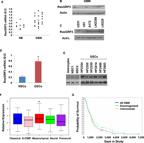 Expression of RasGRP3 in GBM, glioma cell lines and GSCs.