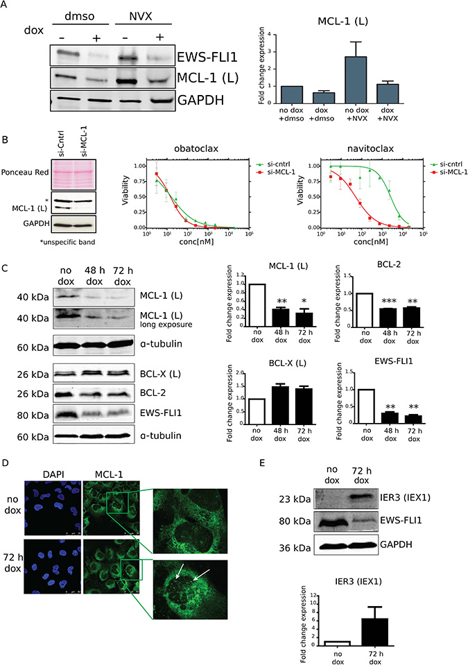 MCL-1 expression levels are EWS-FLI1 dependent and contribute to the drug-induced phenotype.