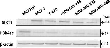 Inverse correlation between SIRT1 and H3k4ac expression levels in 5 intrinsic breast cancer cell lines compared to normal breast cell line.