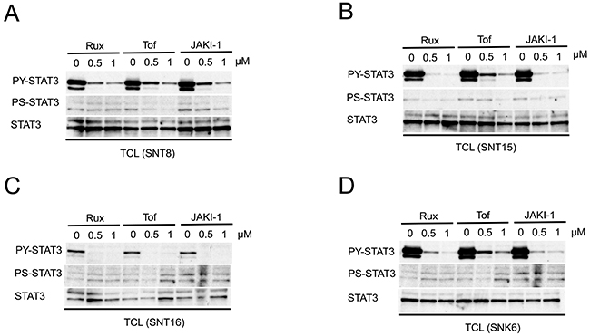 JAK inhibitors suppress the constitutive phosphorylation of STAT3 in EBV-positive T- or NK-cell lines.