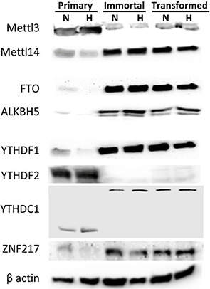 Protein expression of m6A methyltransferases, demethylases and RNA binding proteins changes during HMEC immortalization/transformation.