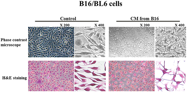 Effect of CM on the morphology of B16/BL6 cells.