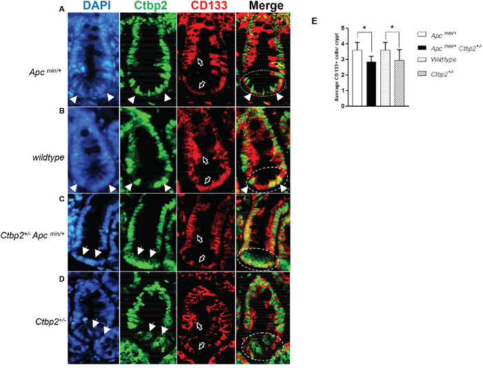 CD133 expression is ablated in Ctbp2 haploinsufficient intestinal crypts.