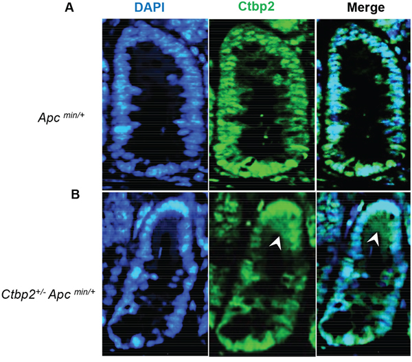 Ctbp2 localization in Ctbp2 wildtype vs. Ctbp2 haploinsufficient Apc min small intestinal polyps.