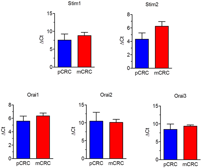 Expression of Stim1-2 and Orai1-3 transcripts in patients-derived colorectal cancer cells.