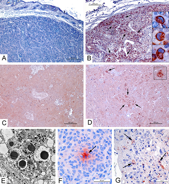 Apoptin production by VVdGF-ApoS24/2 strain and apoptosis in carcinoma A431 xenografts.