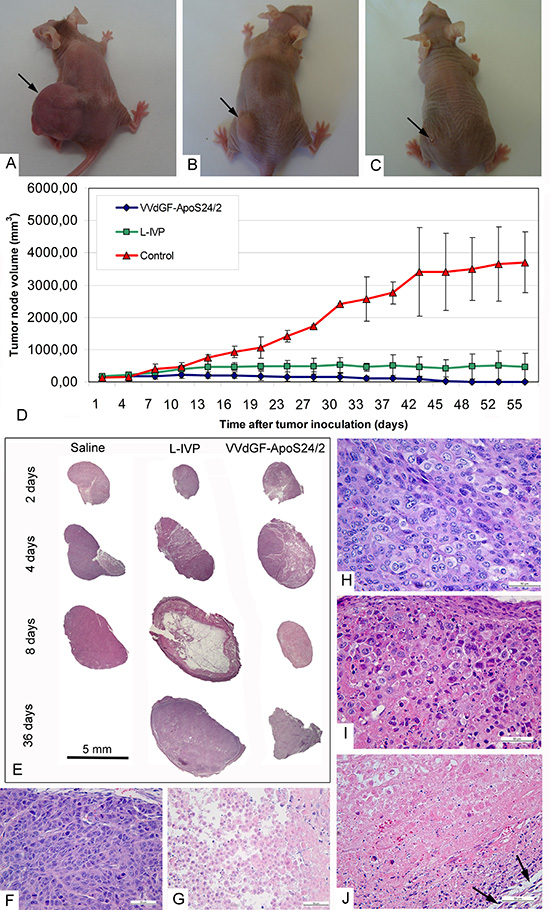 Regression and histological characteristics of A431 tumors in mice after single intratumoral injection of the VACV L-IVP or VVdGF-ApoS24/2 strains.