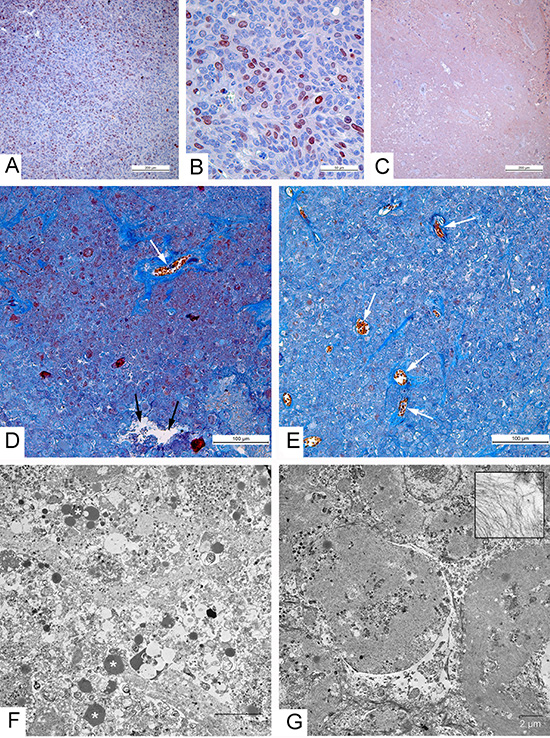 Morphological characteristics of carcinoma A431 xenografts in mice.