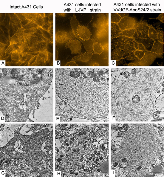 Disorganization of cytoskeleton in carcinoma A431 cells caused by VACV strains in vitro and in vivo.