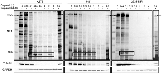 CAPN1 is responsible for NF1 degradation in vitro.