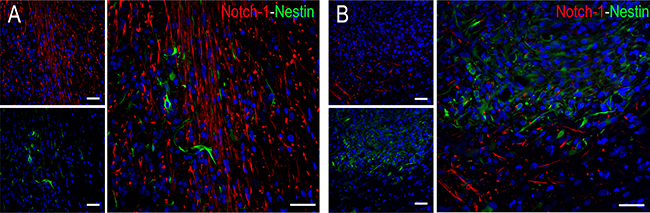 Co-expression study of Notch-1 (red) and nestin (green) in stage III.