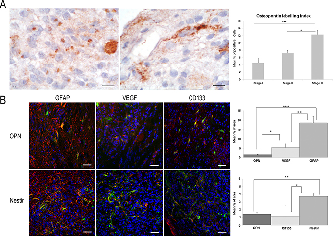 Study of OPN immunoexpression in ENU-glioma stages of development.